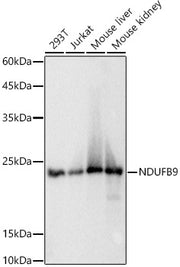 NDUFB9 Rabbit mAb