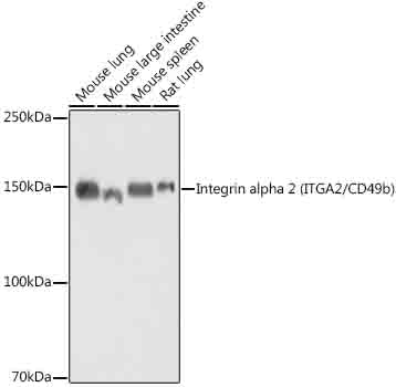 NDUFB9 Rabbit mAb