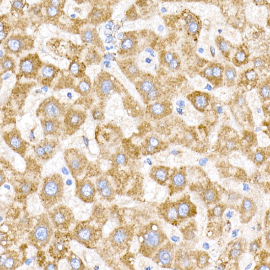 NDUFB9 Rabbit mAb