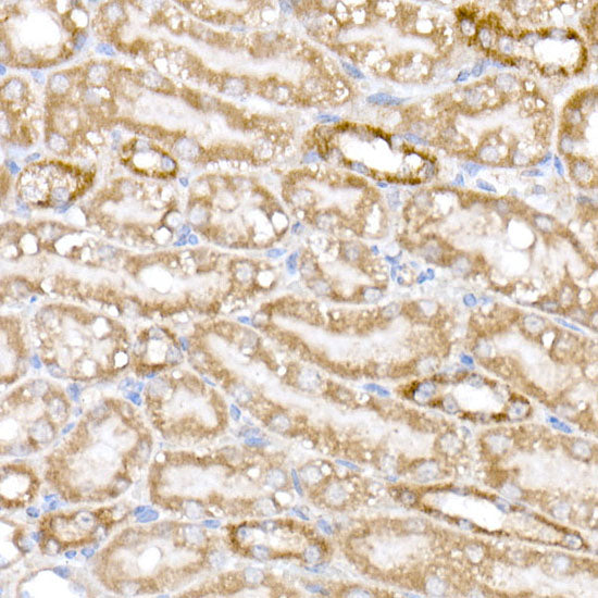 NDUFB9 Rabbit mAb