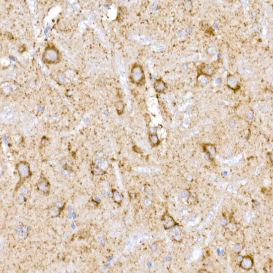 NDUFB9 Rabbit mAb
