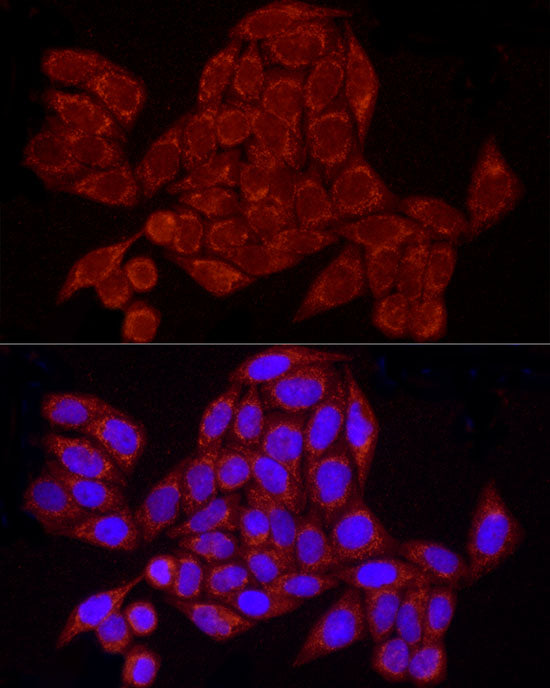 GRSF1 Rabbit mAb