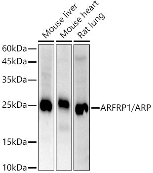 ARFRP1 / ARP  Rabbit mAb