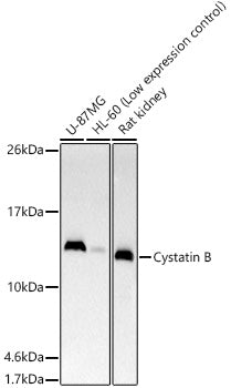 Cystatin B Rabbit mAb