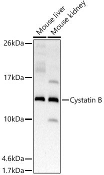Cystatin B Rabbit mAb