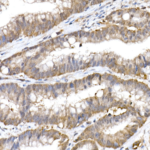Ube2L3 / UBCH7 Rabbit mAb