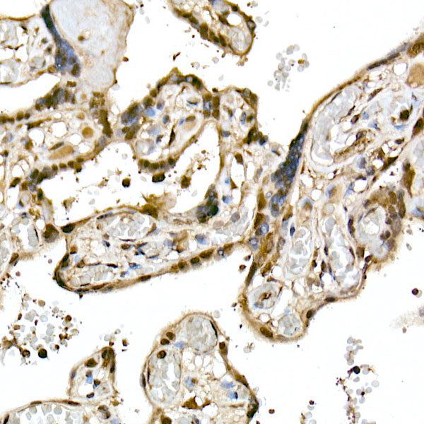 Ube2L3 / UBCH7 Rabbit mAb