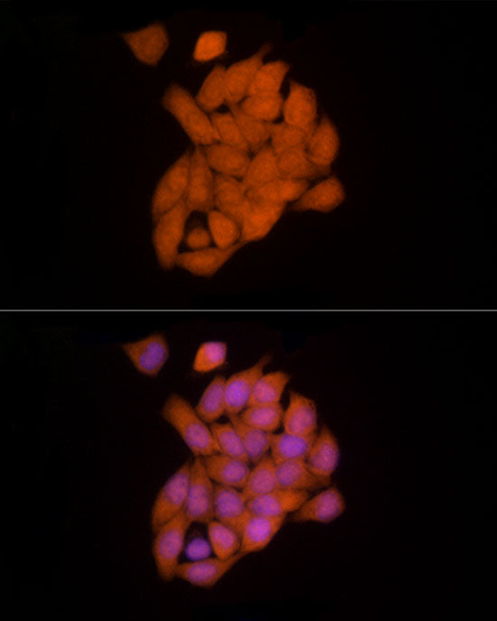 Ube2L3 / UBCH7 Rabbit mAb