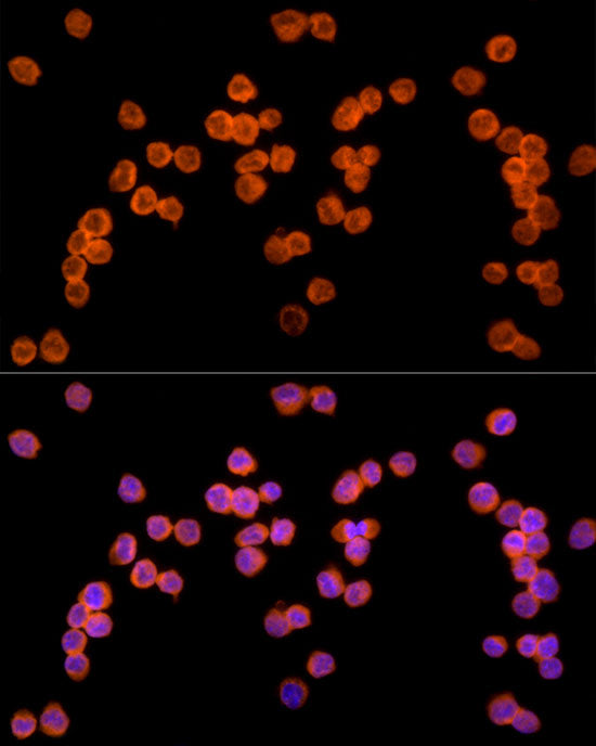 Ube2L3 / UBCH7 Rabbit mAb