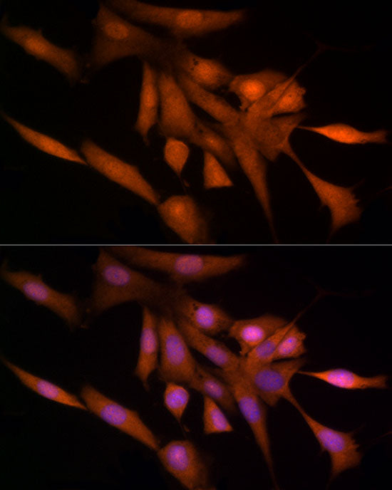 Ube2L3 / UBCH7 Rabbit mAb
