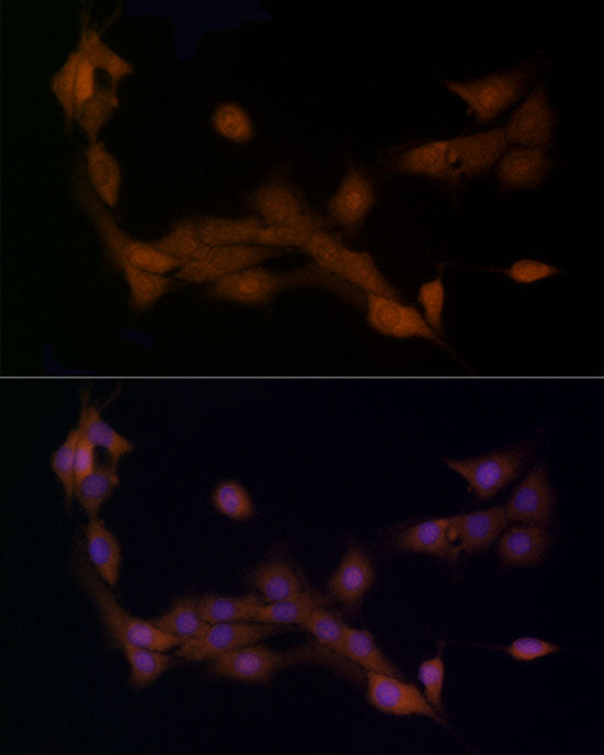 Ube2L3 / UBCH7 Rabbit mAb