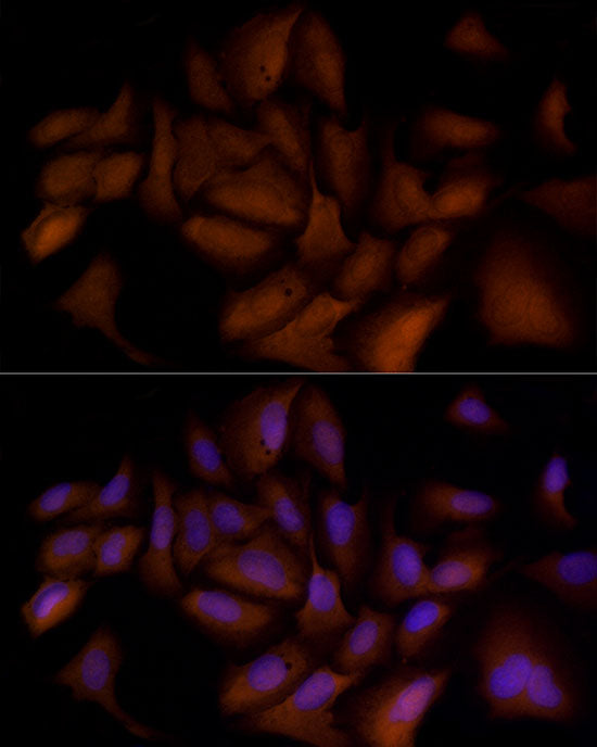 Ube2L3 / UBCH7 Rabbit mAb