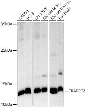 TRAPPC2 Rabbit mAb