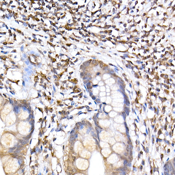 TRAPPC2 Rabbit mAb