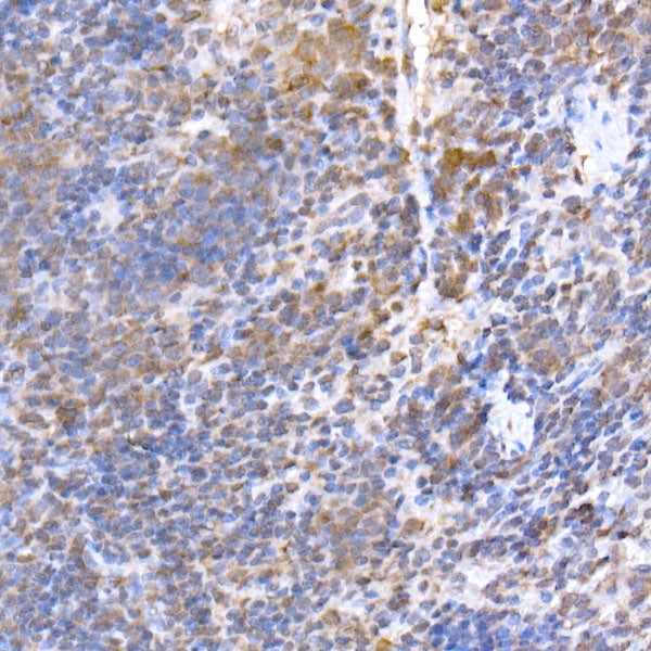 TRAPPC2 Rabbit mAb
