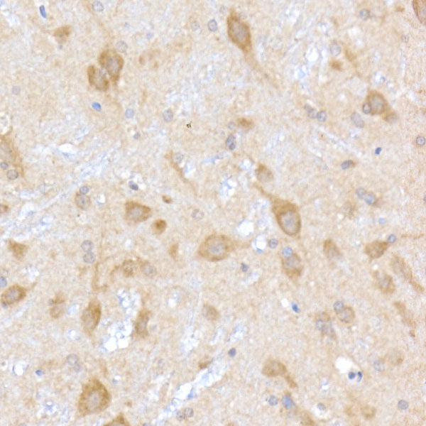 TRAPPC2 Rabbit mAb
