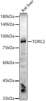 TORC2 Rabbit mAb