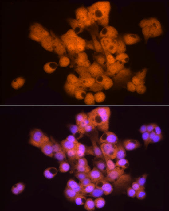 HINT1 Rabbit mAb