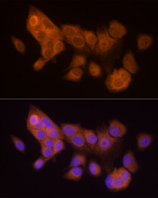 HINT1 Rabbit mAb