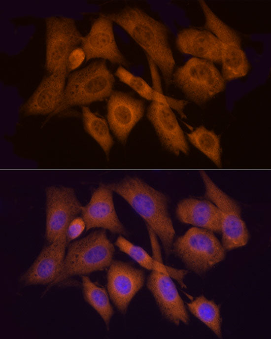 HINT1 Rabbit mAb