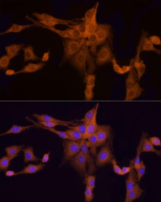 HINT1 Rabbit mAb