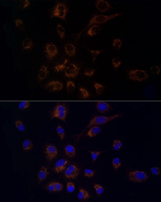 FDX1/ADX Rabbit mAb