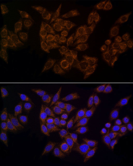 FDX1/ADX Rabbit mAb