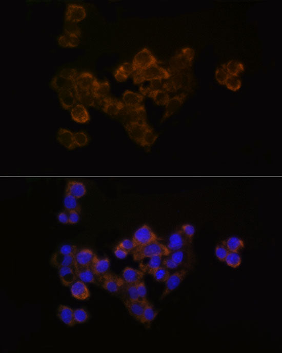 FDX1/ADX Rabbit mAb