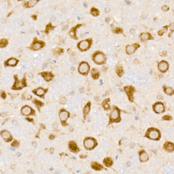 HDLBP Rabbit mAb