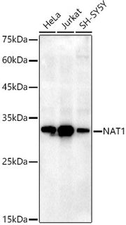 NAT1 Rabbit mAb