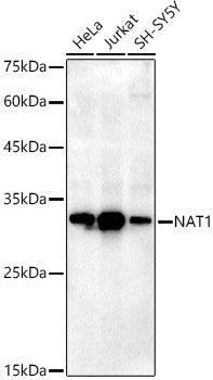 NAT1 Rabbit mAb