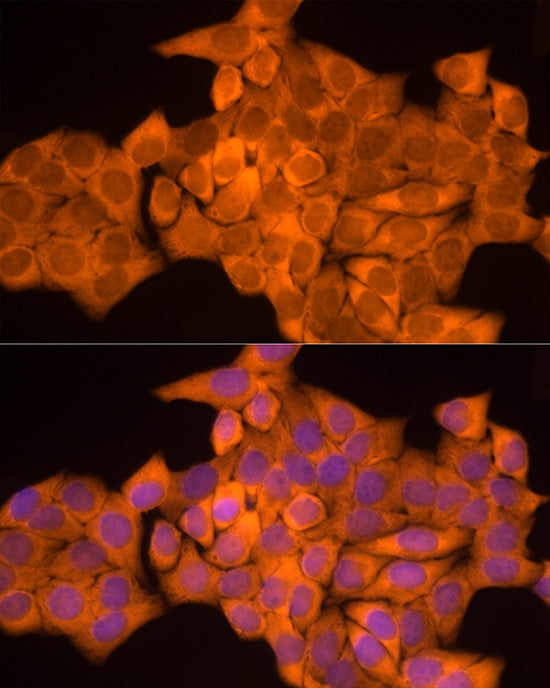 NAT1 Rabbit mAb