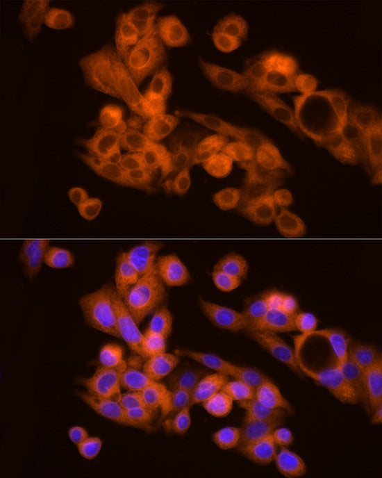 NAT1 Rabbit mAb