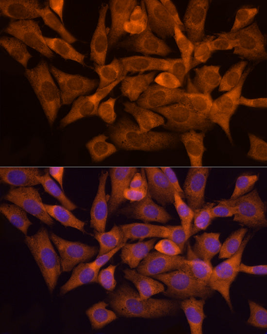 NAT1 Rabbit mAb