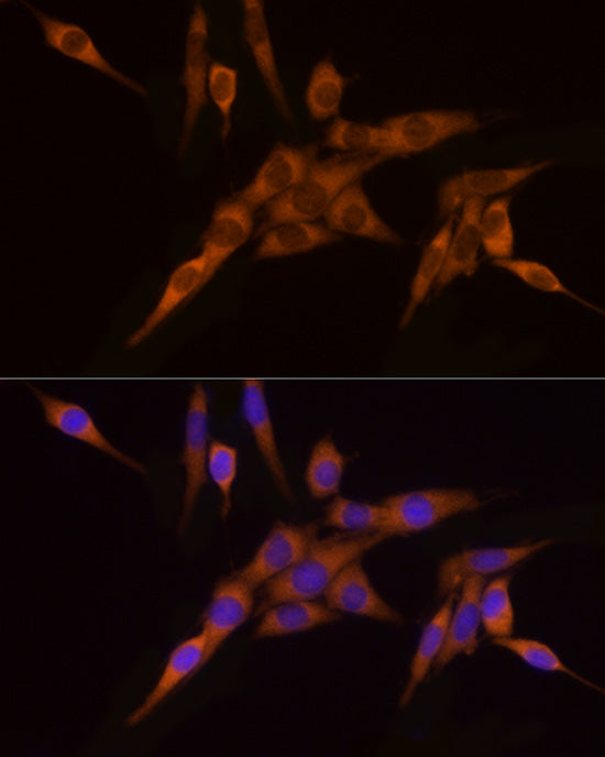 NAT1 Rabbit mAb