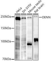 DENN Rabbit mAb