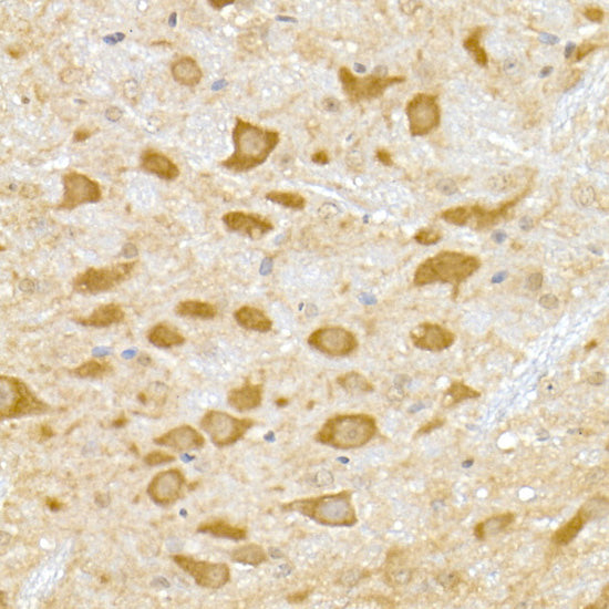 DENN Rabbit mAb