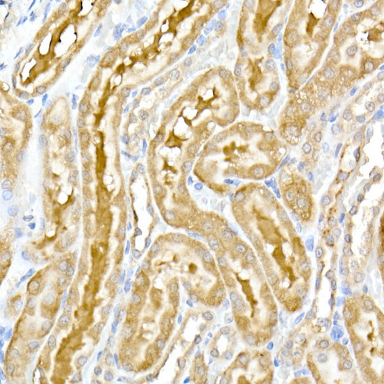 DENN Rabbit mAb