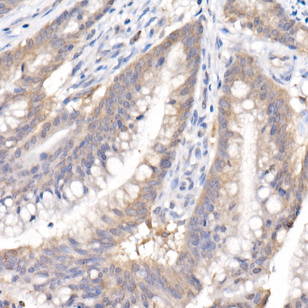 SARA Rabbit mAb