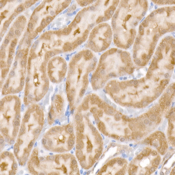 SARA Rabbit mAb
