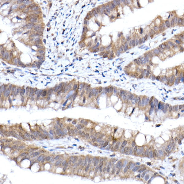 Importin 9 / RANBP9 Rabbit mAb