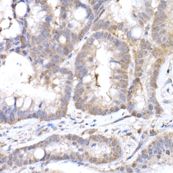 MTAP Rabbit mAb