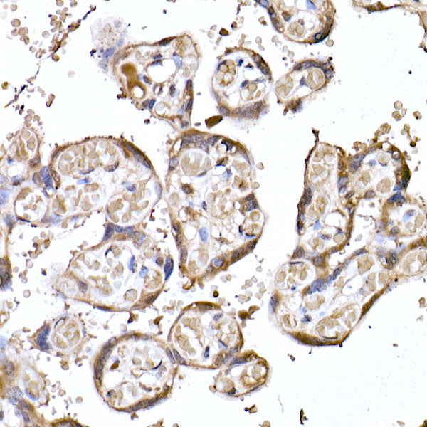 MTAP Rabbit mAb