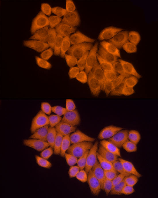 MTAP Rabbit mAb