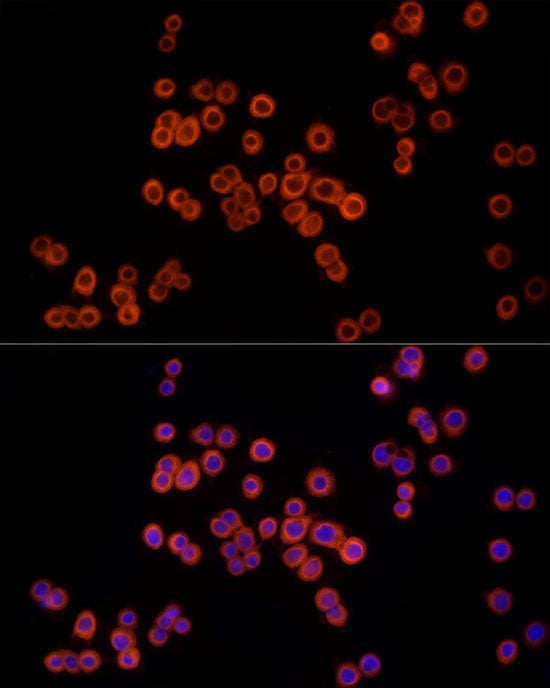 MTAP Rabbit mAb