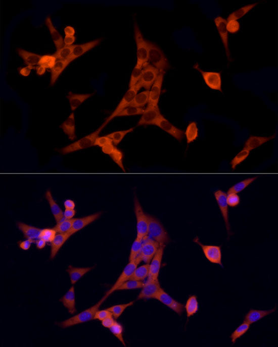 MTAP Rabbit mAb