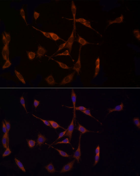 MTAP Rabbit mAb