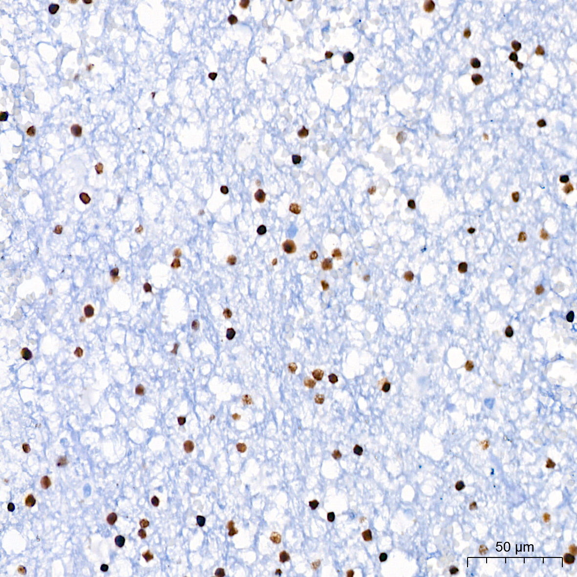Nucleolin Rabbit mAb