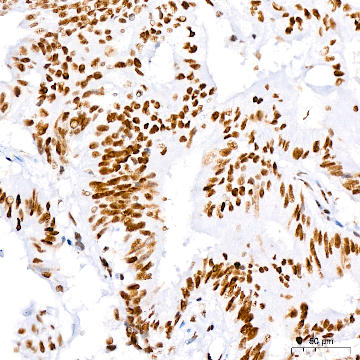 Nucleolin Rabbit mAb