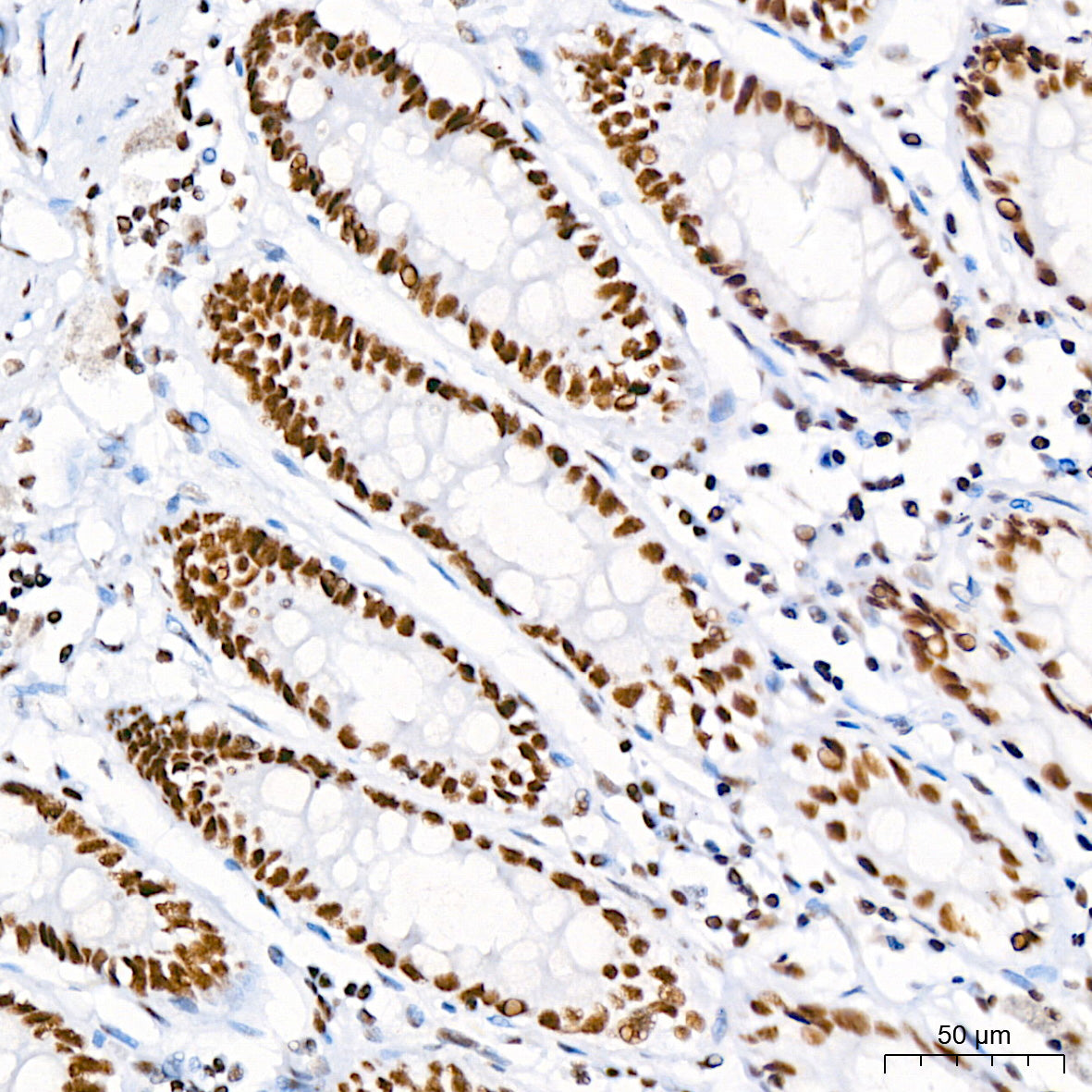 Nucleolin Rabbit mAb